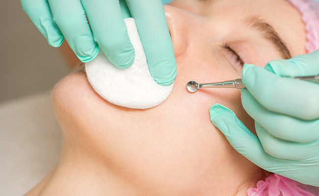 Blackhead extraction