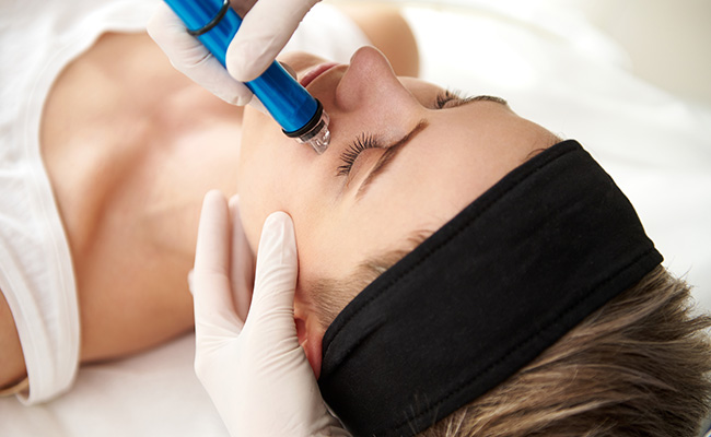 Microdermabrasion