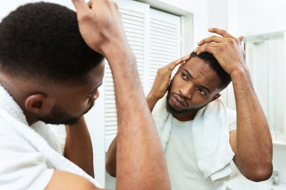 dandruff winter hair woes