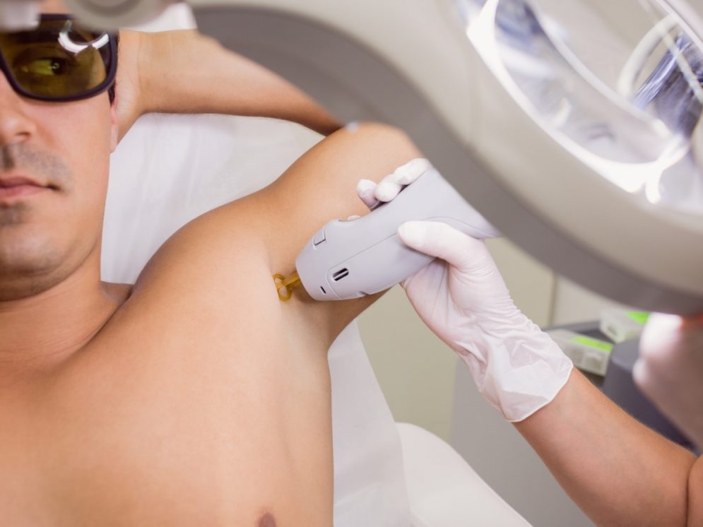 How does IPL hair removal work?