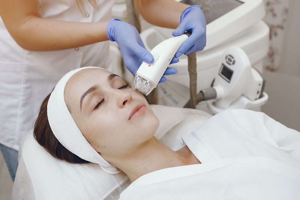 Laser resurfacing