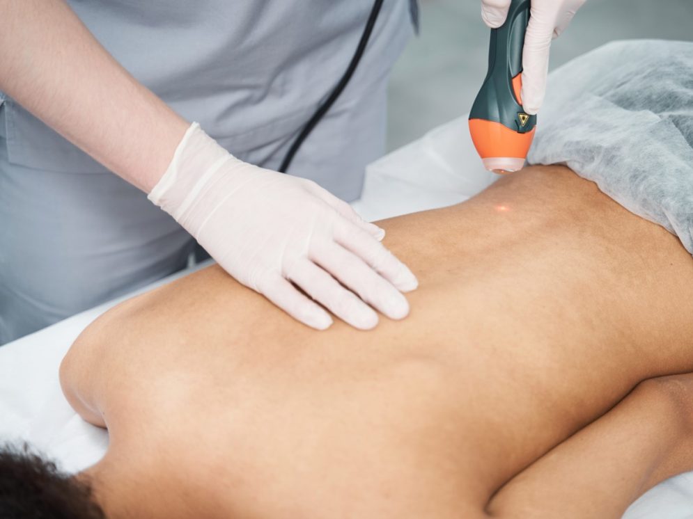 Laser therapy